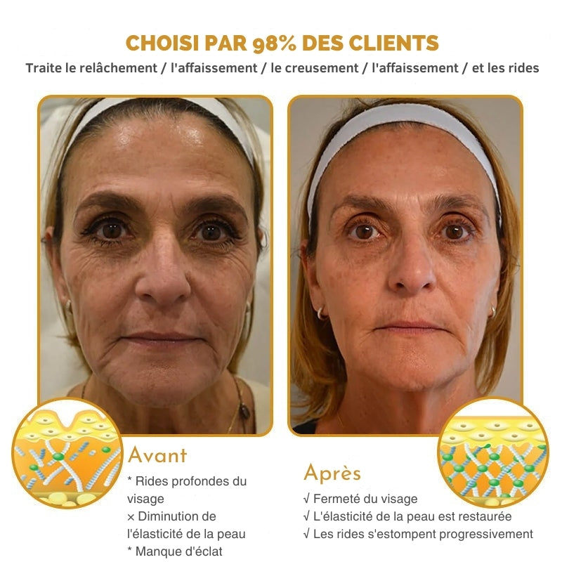 Miely™ - Une peau éclatante, une meilleure confiance en soi
